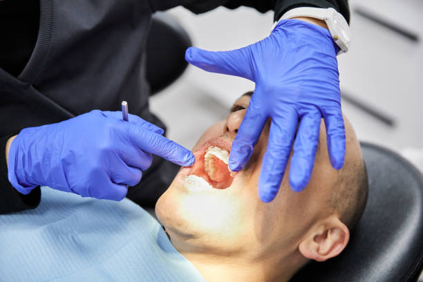 Best Broken Tooth Emergency  in Cornelia, GA
